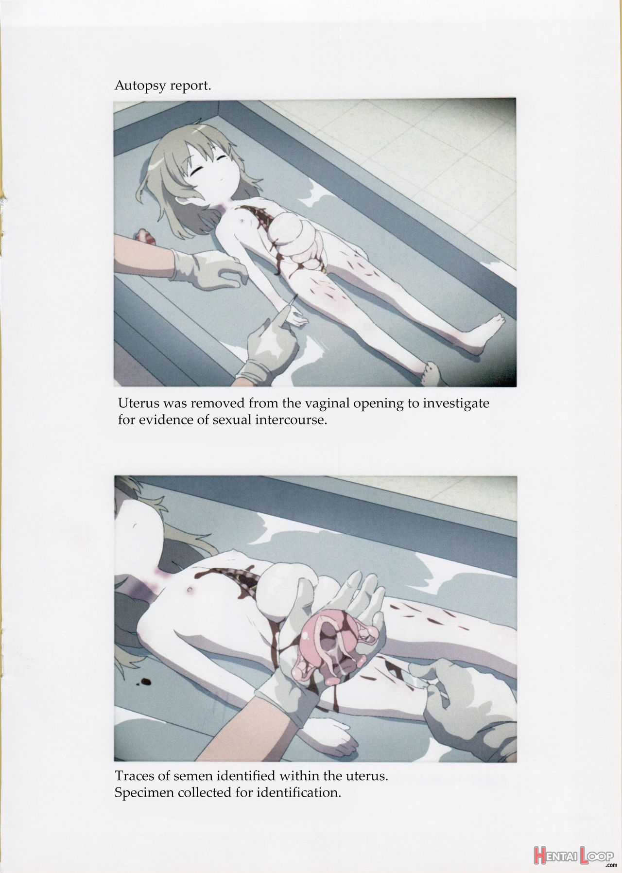 Nishi-ogikubo Girl Murder Case Judicial Autopsy Report page 7