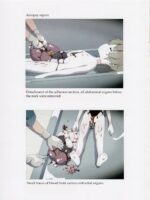 Nishi-ogikubo Girl Murder Case Judicial Autopsy Report page 8