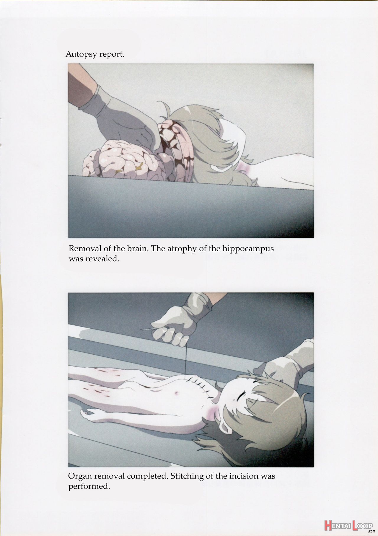 Nishi-ogikubo Girl Murder Case Judicial Autopsy Report page 9